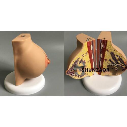 Female Stationary Stage Breast Model Beauty Gynecological Anatomy model medical teaching tools