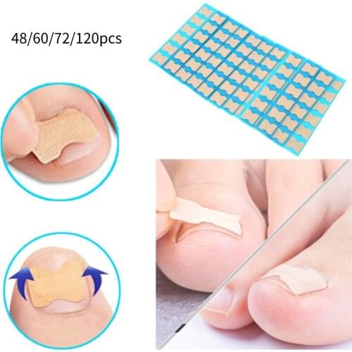 48/60/72/120pcs Ingrown Toenail Correction Patch Corrector Non Glue Sticker Toe Nail Paronychia Treatment Foot Care Pedicure