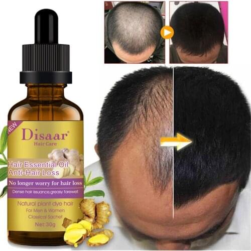 7 Days Ginger Hair Growth Essence Oils Germinal Fast Hair Growth Serum Prevent Baldness Hair Loss Treatment Anti-hair Loss Care