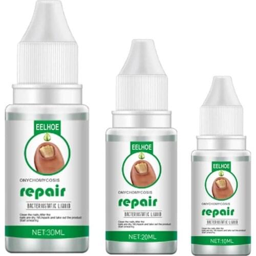 10/20/30ML Fungal Nail Treatment Serum Onychomycosis Paronychia Anti-Fungal Nail Infection Herbal Fungus Foot Repair Essence