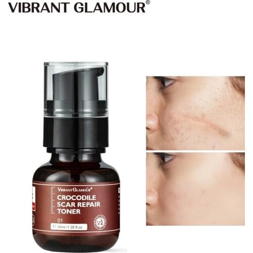 VIBRANT GLAMOUR Crocodile Scar Repair Toner Reduce Scar Area Fade Scar Color Prevent Scar Hyperplasia Sensitive Skin Deep Care