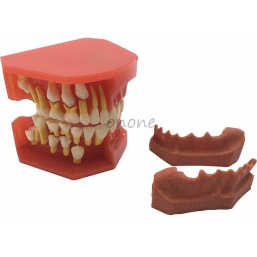 1pcs Dental Tooth Teeth Anatomical Anatomy Model Children Dental Model Baby teeth mold