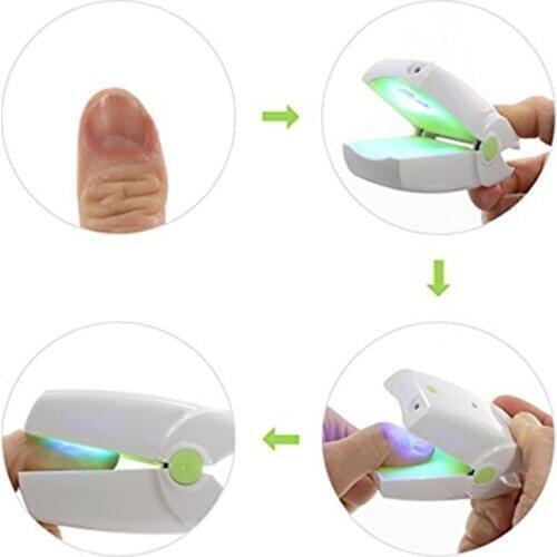 Painless 904nm Infrared Cold Laser Therapy Device Toe Nail Fungus Treatment Portable Home Use Toe nail Fungus Laser Therapy