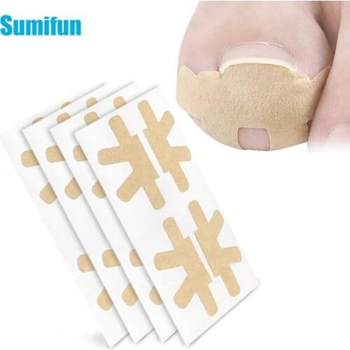 20pcs Professional Embedded Toe Nail Corrector Sticker Ingrown Toenail Care Pedicure Thumb Curl Orthopedic Pastes Nail Care