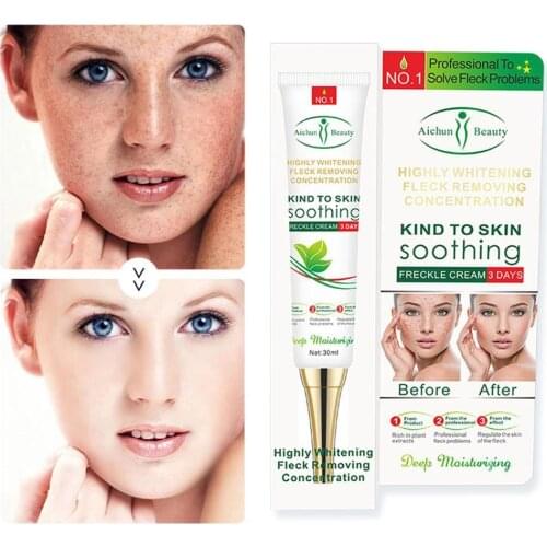 Effective Whitening Freckle Cream Remove Melasma Acne Spot Pigment Melanin Dark Spots Moisturizing Cream Skin Care Cosmetics