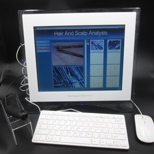 15 inch touch screen advanced hair analyzer analysis camera machine for beauty center