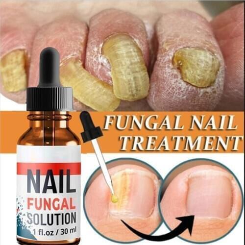 High Quality Nail Repair Solutions Brighten Repair Nourish Toenail Fingernail Nail Care Liquid