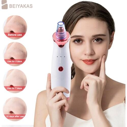 beiyakaS Vacuum Pore Cleaners