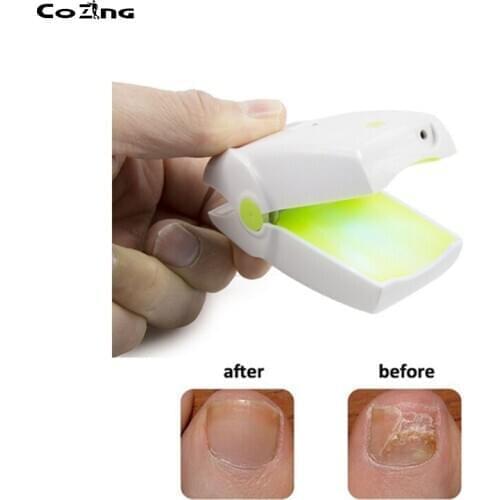 Onychomycosis Treatment Cold Laser Therapy Machine For Paronychia Anti Fungal Nail Infection Bacteria
