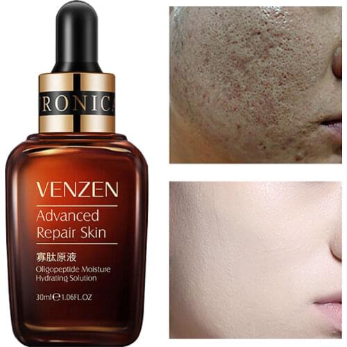 1Pcs Face Serum Moisturizing Nourish Repair Improve Rough Brighten Oil-Control Anti-Wrinkle Firm Hyaluronic Acid Skin Care 30ml