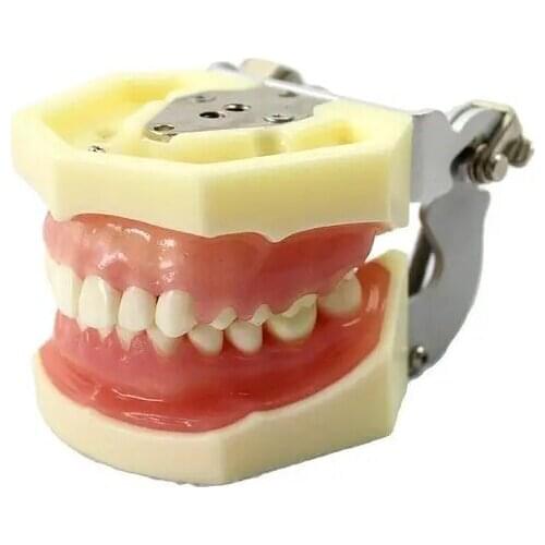 Dental Gingival Disease Teeth Model Peridontal Disease Model Implant Practice Jaw Model Teeth