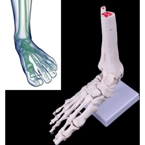 Life size Foot Ankle Joint Anatomical Skeleton Model Display Study Tool M5TE
