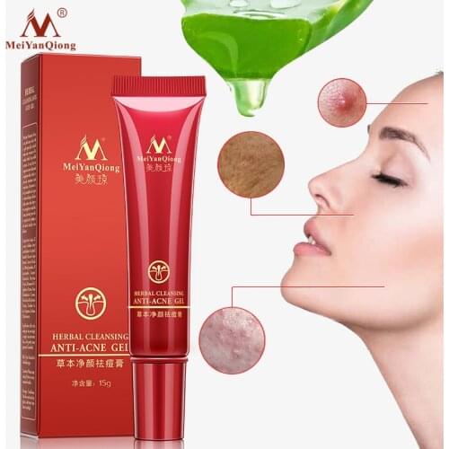 Meiyanqiong High Quality Herbal Cleansing Face Anti Acne Treatment Cream Herbal Scar Removal Oily Skin Acne Spots Skin Care