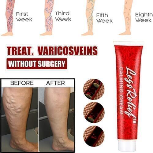 Relieves Pain Cream Reduces Swelling Vein Moisturizing Improves Leg Complexion Calming Cream Body Creams Body Care TSLM2