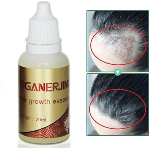 20ml 100% Natural Ginger Hair Growth Essential Oil Liquid Hair Loss products leave-in Hair Scalp Treatments for Hair Care TSLM2