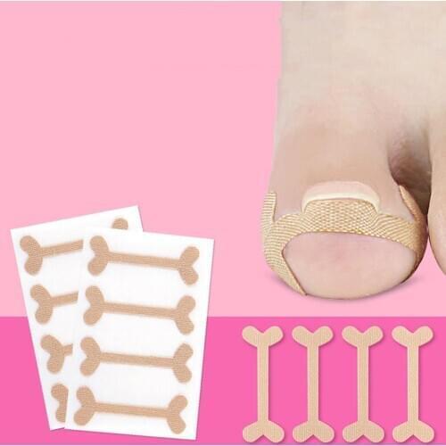 12Pcs Breathable Ingrown Toenail Corrector Stickers Nail Treatment Elastic Patch