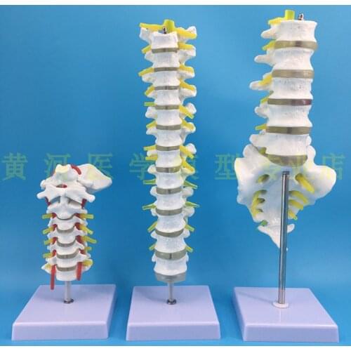 1:1 spine model human skeletal model cervical vertebra blood vessel thoracic nerve lumbar disc