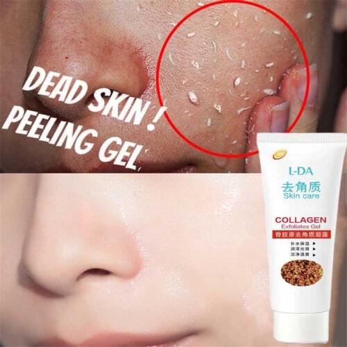 Deep Exfoliating Peeling Gel Moisturizing Whitening Face Exfoliating Gel Dead Skin Removal Acne Gel for Face Cleanses All Skin
