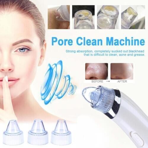 Blackhead Vacuum Electric Pore Cleaner Pimple Nose Blackhead Acne Black Dots Dark Spot Remover for Face Vacuum Cleaner Suction
