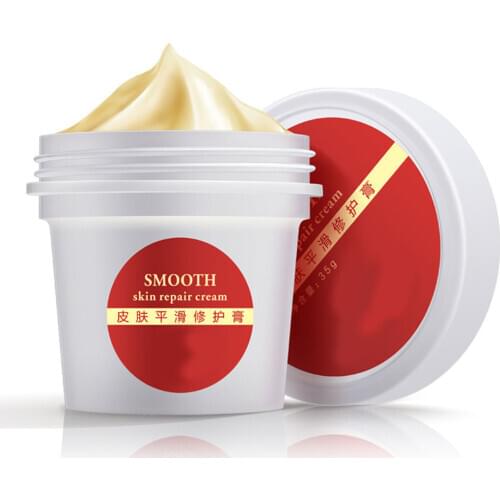Smooth Skin Cream for Stretch Marks Scar Removal Postpartum Skin Repair Body Cream @ME88