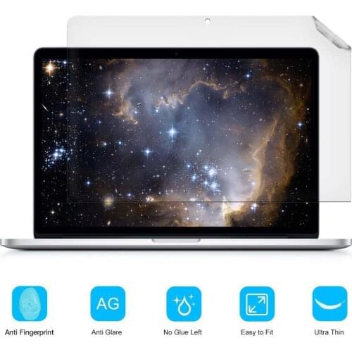 KK&LL For Apple Macbook Pro Macbook retina12 inch Model A1534 Crystal Clear Lcd Guard Film Screen film Protector