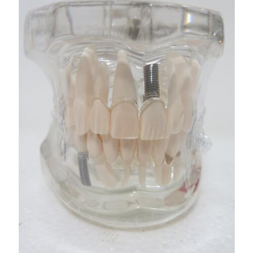 Dental materials Oral removable dental pathological model Special decoration Clinic personalized decorative Figurines