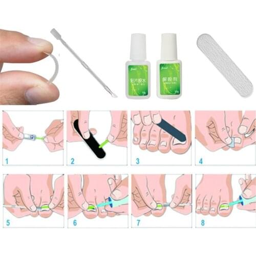 100pc/Box Transparent Ingrown Pedicure Toenail Straightening Clip Toe Nail Sticker Brace Toenial Thick Correction Patch FootCare
