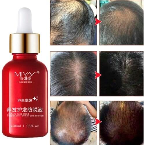 Hair Oil Hair Care Fast Powerful Hair Growth Products Regrowth Essence Liquid Treatment Preventing Hair Loss For Men And Women