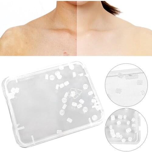 30pcs/box Callus Painless Rubber Bands Home Exfoliating Scrub Mole Non Toxic Skin Tag Remover Face Care Body Acne Nevus