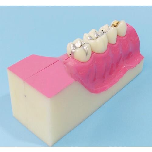 Right lower tooth Tissue decomposition model Dental model Classroom explanation display props for doctors and patients