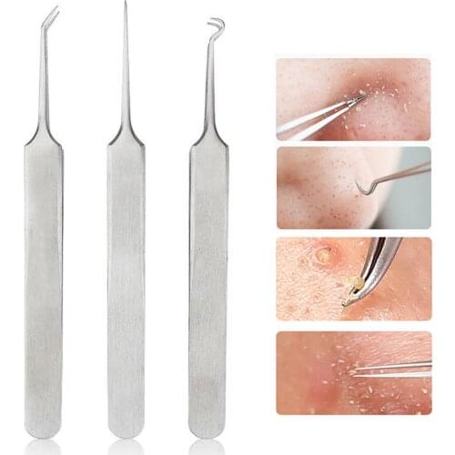 3Pcs Stainless Steel Acne Needle Tweezers Straight Curved Blackhead Comedone Clip Needles Tweezers Pimple Extractor Remover 222