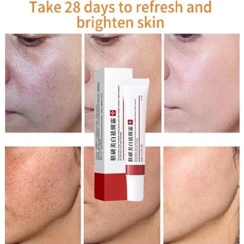 2pcs/lot Whitening Cream For Dark Skin Remove Freckle Melasma Acne Spot Dark Spots Brightening Moisturizing Gel Face Skin Care