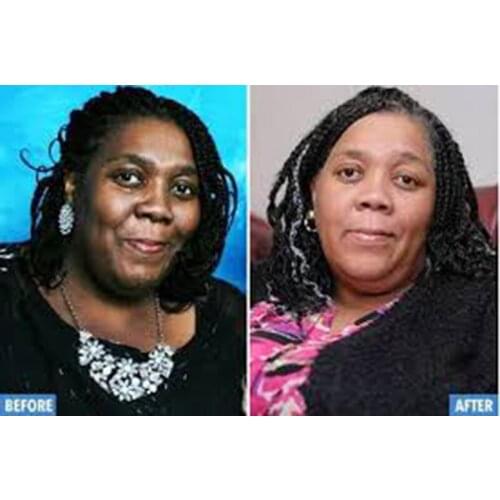 Hyaluronic Acid Moisturizing Face Serum Remove Fine Lines Anti-Aging Anti-Wrinkle Firming Deep Skin Care15ml Acne Treatment