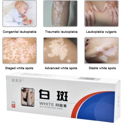 20g Chinese Medical White Spot Disease Cream Pigment Melanin Promoting Liniment Skin Vitiligo Leukoplakia Disease Treatment