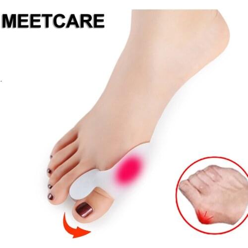 Women Feet Care Hallux Valgus One Ring Big Toe Small Toe Orthopedic Braces Correct Daily Silicone Toes Small Bone Foot Care Soft
