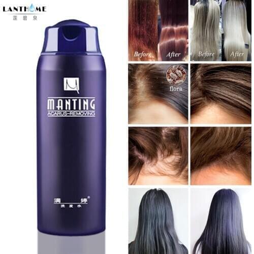 ManTing Professional Shampoo Divide Mite Anti-Itching Anti Dandruff Suitable No Silicone Oil Oil Control for All Hair Types
