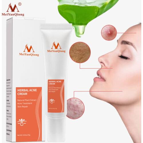 MerYanQiong Acne Treatment Gel Remove Pimples Face Acne Scars Cream Anti Acne Removal Cream Shrink Pores Whitening Face Cream