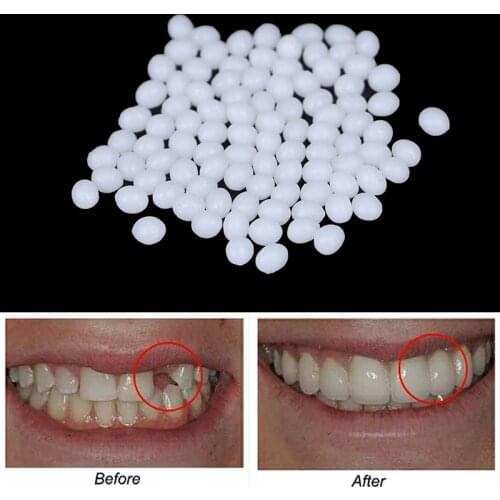 MceHKF Teeth Whitening Kits