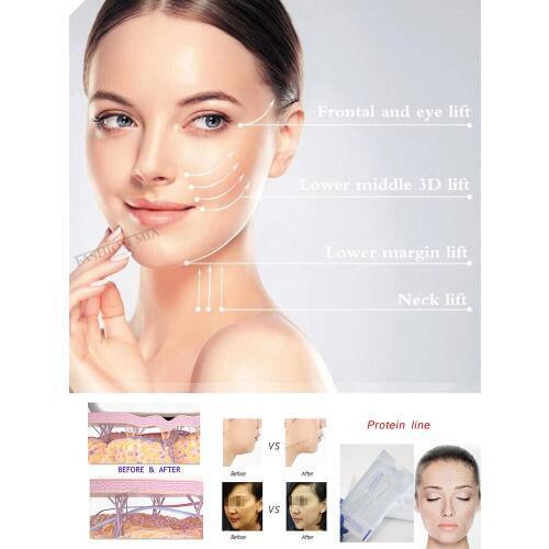 Silk Fibroin Line Collagen Facial Thread Lift Anti Aging Carving Essence Hyaluronic Tightening Skin Care Radar Thread No Needle