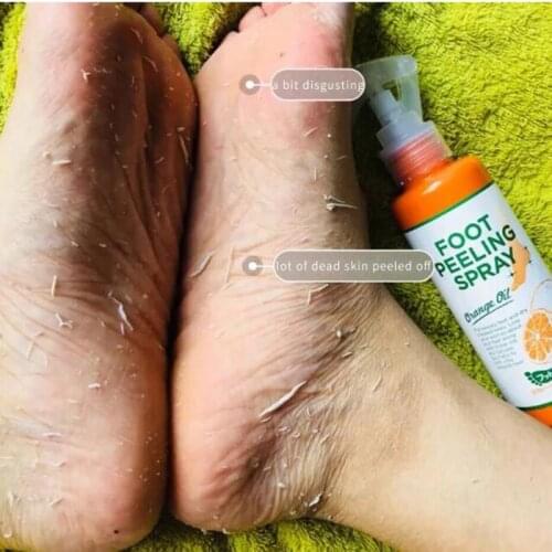 110ml New Natural Orange Essence Foot Peeling Spray Pedicure Hands Dead Skin Exfoliator Mask Essence Foot Care Cream Hot
