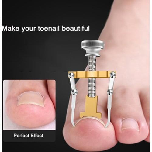 Ingrown Toenail Toe Fixer Recover Correction Device Pedicure Foot Nail Care Tool Straightening Clip Brace corrector Easy to Use