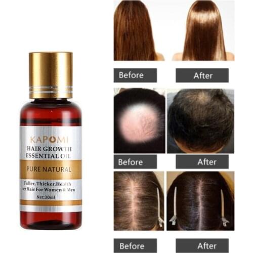 Hair Care Hair Growth Essential Oils Essence 100% Hair Loss Liquid Health Care Beauty Dense Hair Growth Serum