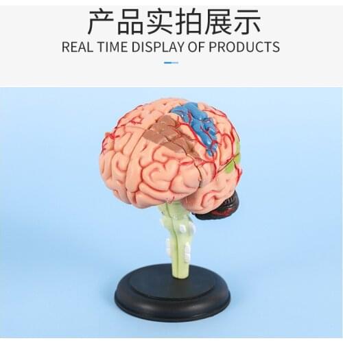 Brain Anatomical Model Brain Model Brain Structure Model Hindbrain Cerebellum