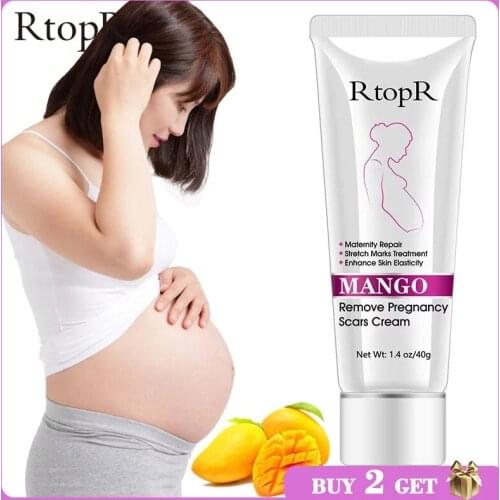 Mango Remove Pregnancy Scars Acne Cream Stretch Marks Treatment Maternity Repair Anti-Aging Anti-Winkles Firming Body Creams