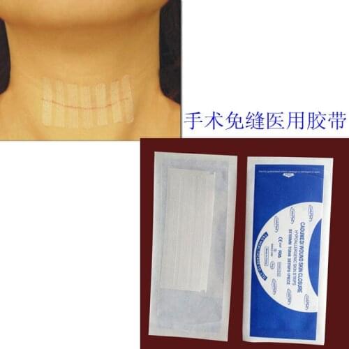 5pcs Expired 12*100mm 3strips Medical tape breathable tape disembowelment scar repair cerecloths producing