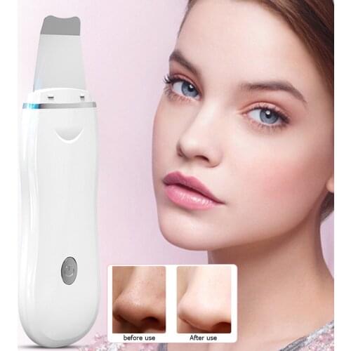Ultrasonic Skin Scrubber Vibration Face Spatula Blackhead Remover Scrubber Shovel Facial Cleaner Peeling Facial Exfoliation