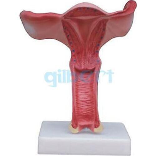 1.5X Magnified Human Female Uterus Anatomy Medical Model Professional Education