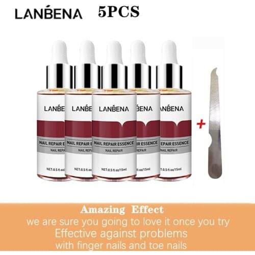LANBENA Nail Repair Essence Serum Fungus Removal Nails Gel Anti Infection Paronychia Onychomycosis Hand Foot Nails Care 5Pcs/Set