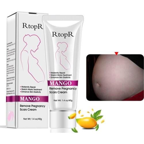 RtopR 40ml Mango Stretch Marks Remover Cream Maternity Repair Treatment Anti Winkle Firm Skin & Eliminate Pregnancy Scars