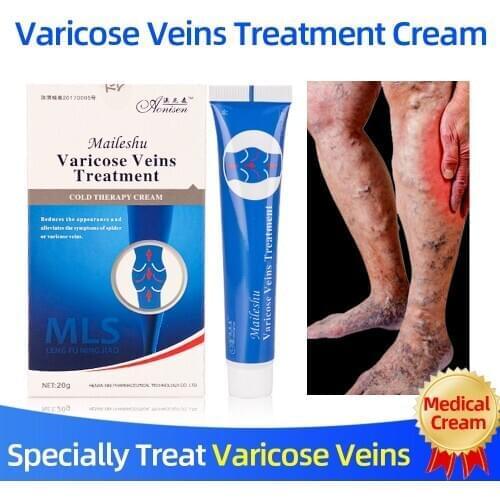 Varicose veins Treatment Cold Compress Cream Treatment Varicose Vasculitis Phlebitis Spider Legs Veins Pain Health Care Plaster